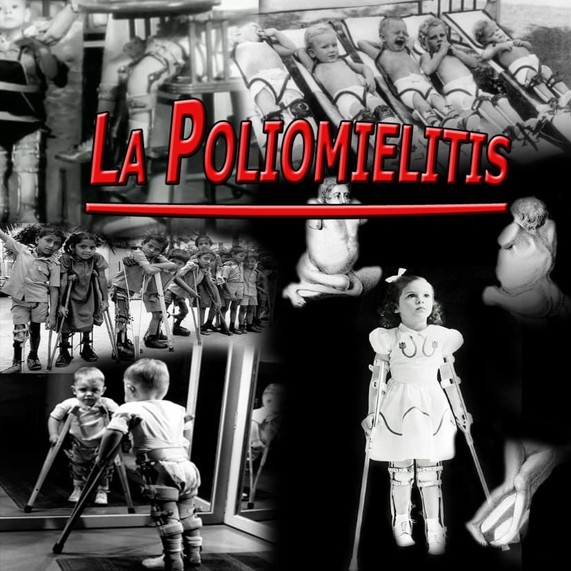 La Polimielitis